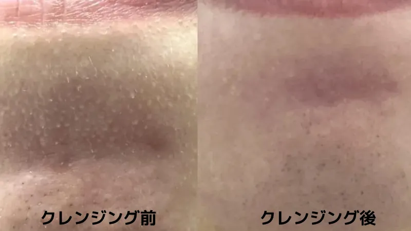 フルリクレンジング 角栓 比較